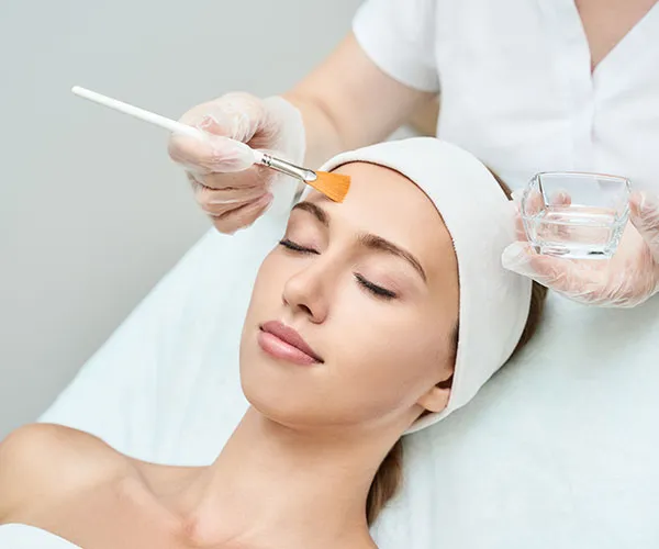 Chemical Peels
